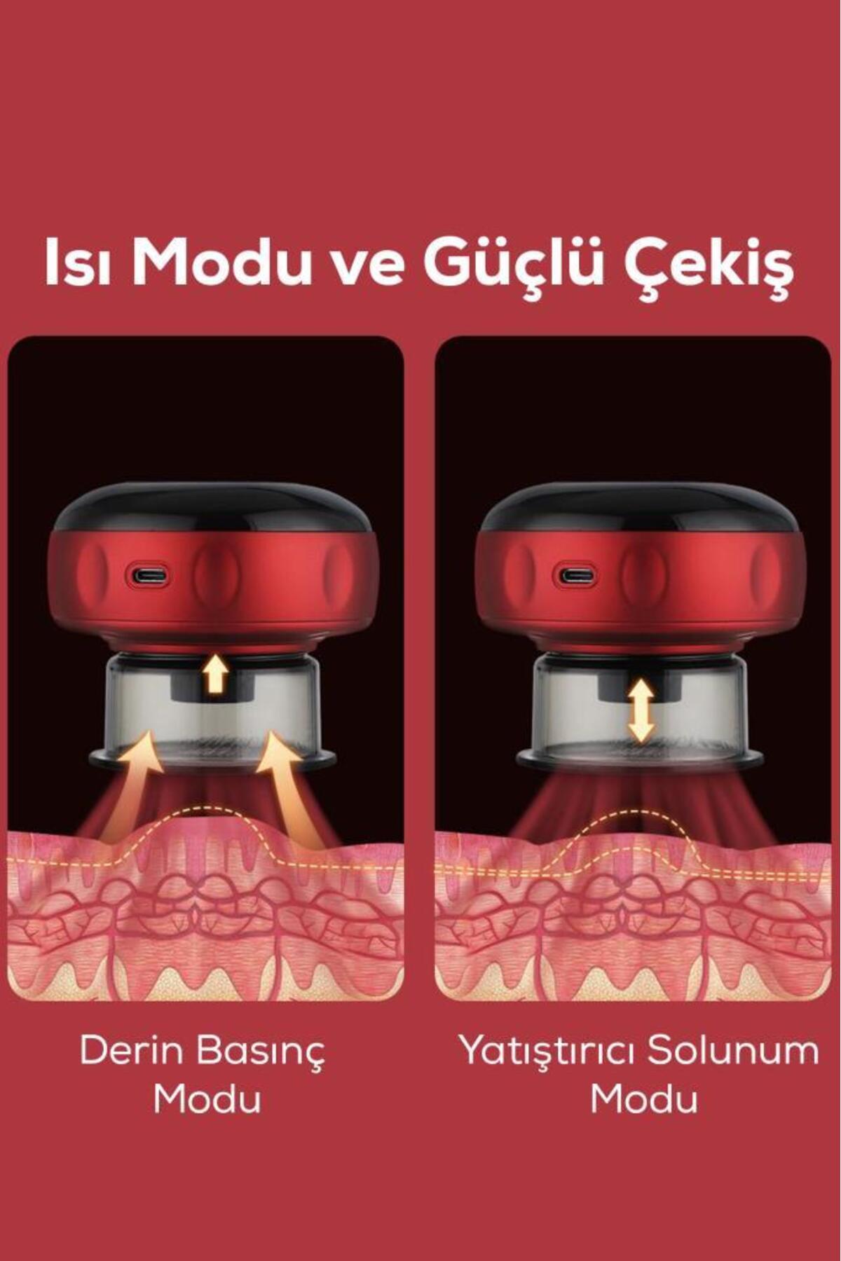 Kablosuz Elektronik Vakum ve Hacamat Aleti