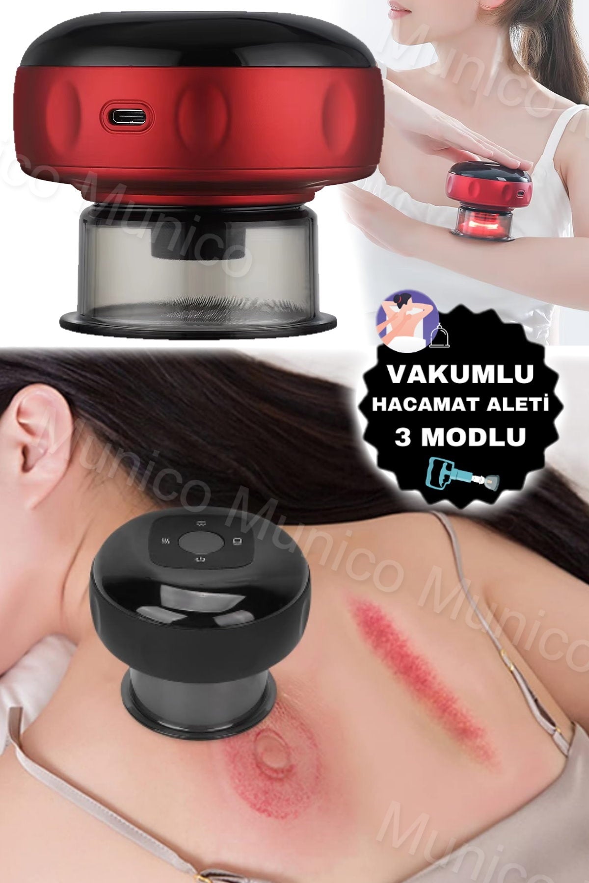 Akıllı Vakumlu Hacamat Cihazı – Sabit Sıcaklık ve Isıtmalı Kupa Terapi Masaj Aleti